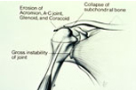 traitement-chirurgical